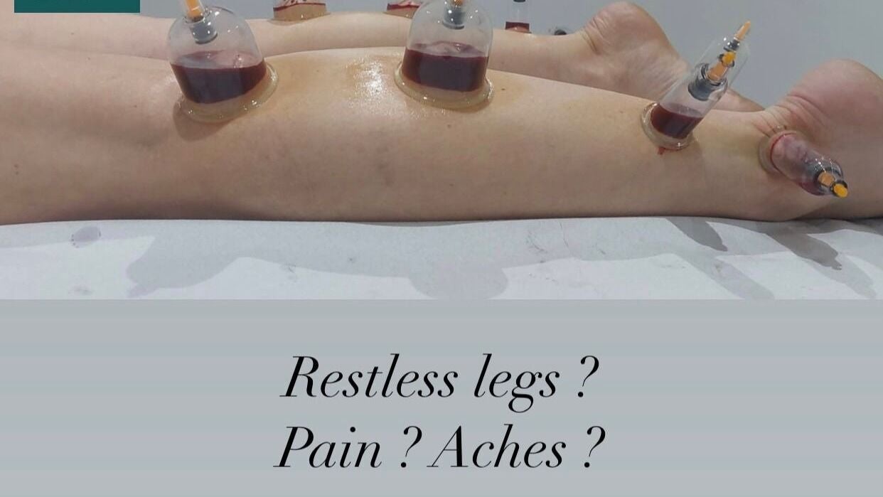 Cupping therapy applied to the leg for aches and pains